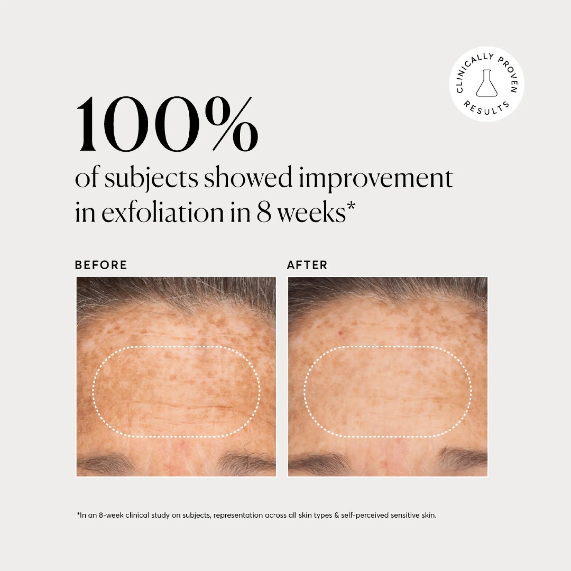 bha-liquid-exfoliant-2-b4 NATR-10027-Alt-Images-BHA-Liquid-Exfoliant-2_-03.webp